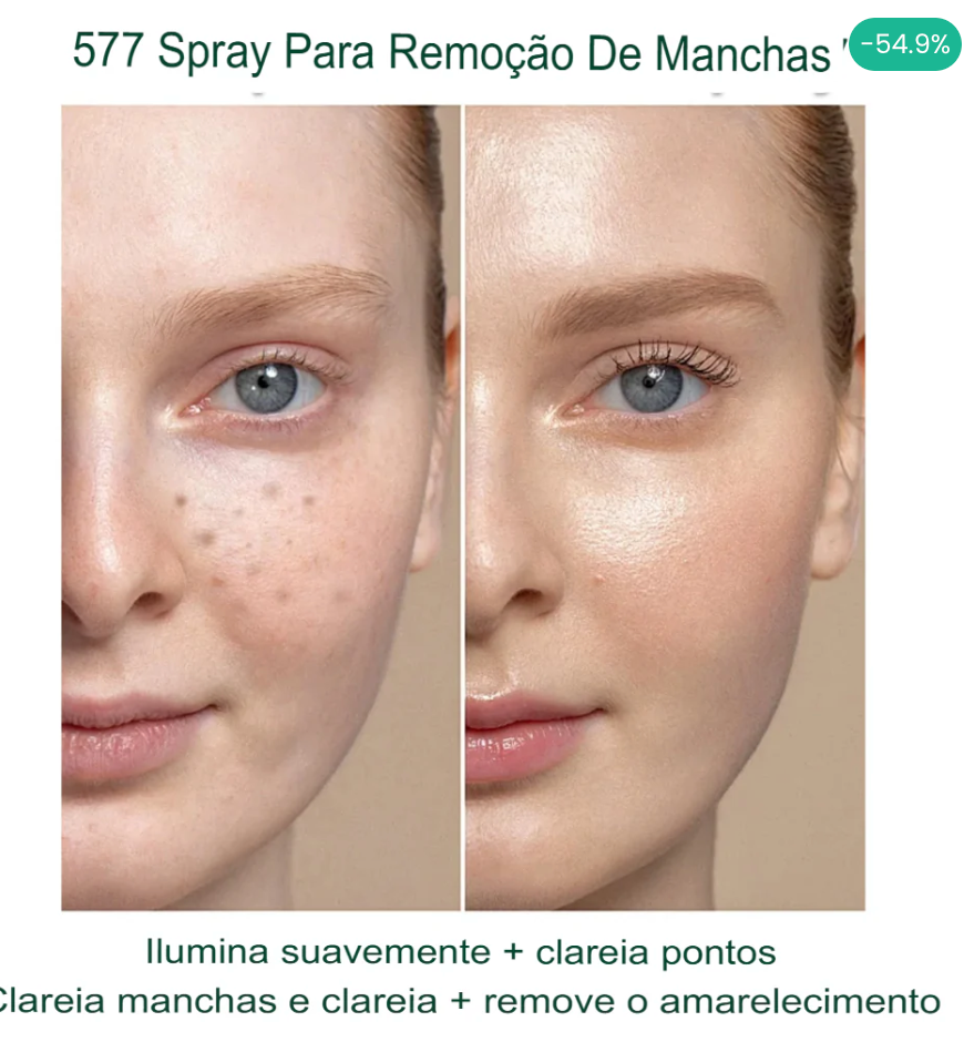 Revitta 577 Spray
