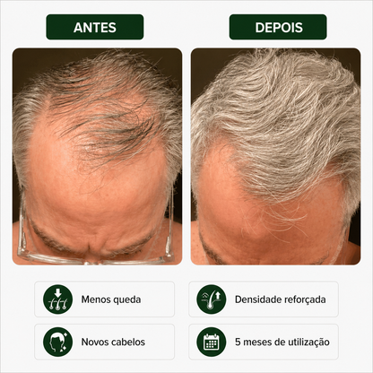 Sérum Capilar Bio Densyl