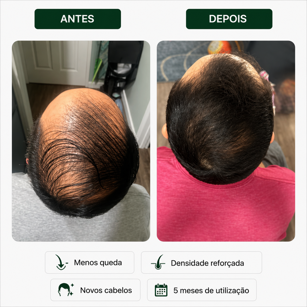 Sérum Capilar Bio Densyl